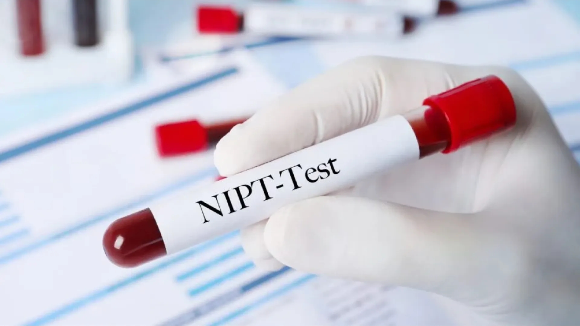 آزمایش nipt چیست و چرا برای زنان باردار ضروری است؟